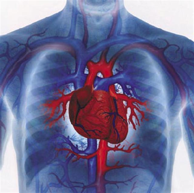Инфаркт миокарда – от чего происходит, чем лечат, как предупредить