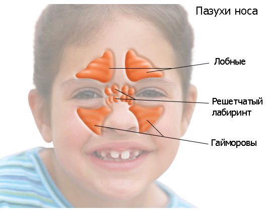 Симптомы и лечение синусита у детей