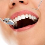 Возможности стоматологии – от отбеливания до имплантации