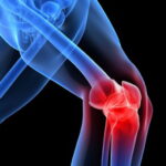 Как избавиться от боли в колене?
