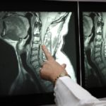диагностика грыжи по МРТ