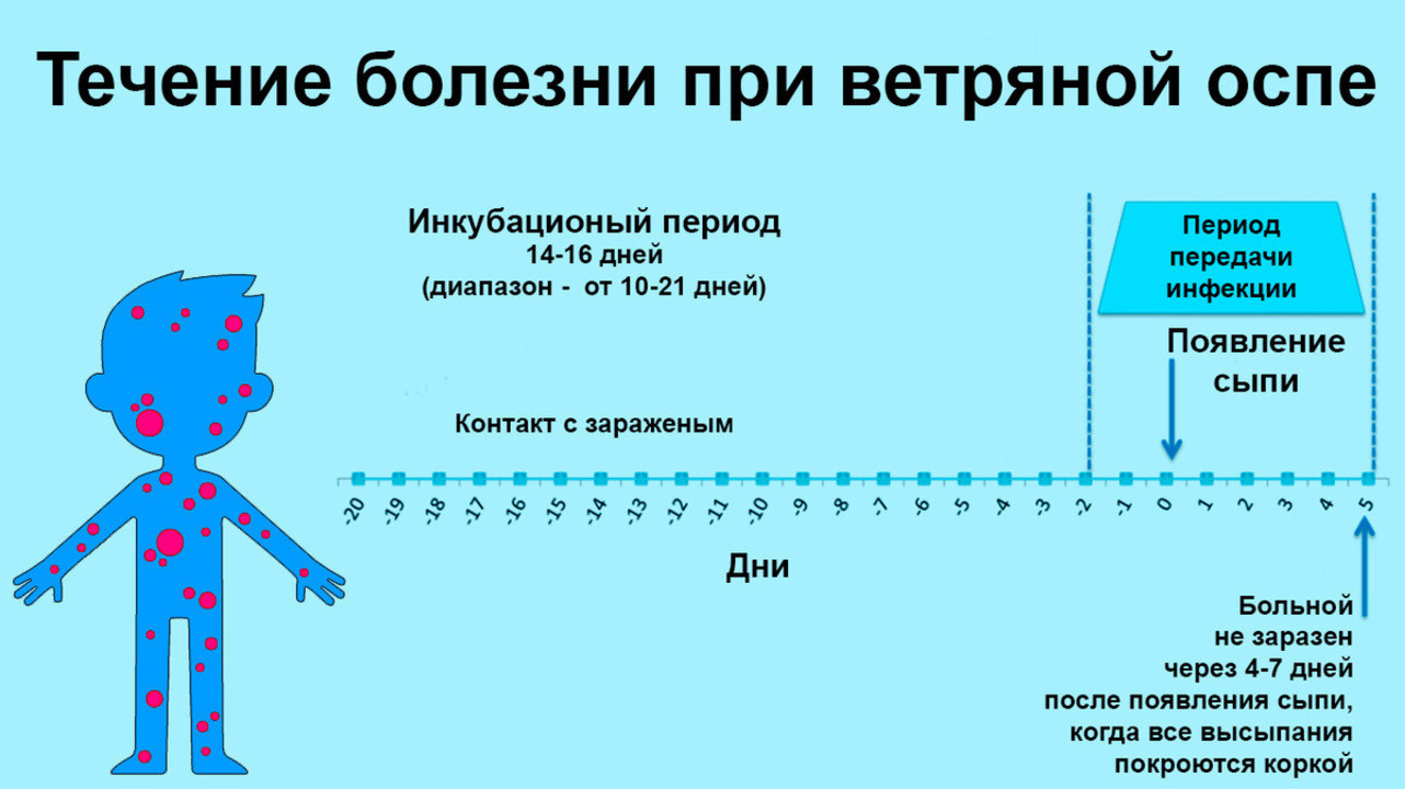 Ветряная оспа картинки лечение